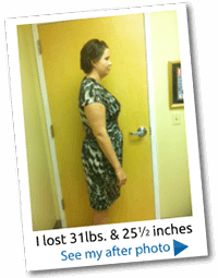 weight-loss-before